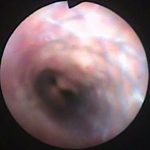 Veterinary Bronchoscopy#422, One month after BS in #406, DSH Cat 11y F, ID6262, ムクノキシロ140928BS